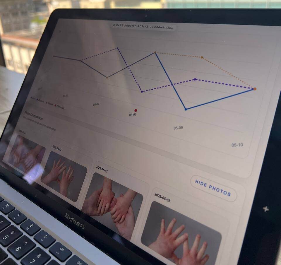 Screenshot of the MyEczema Daily Trigger Tracker