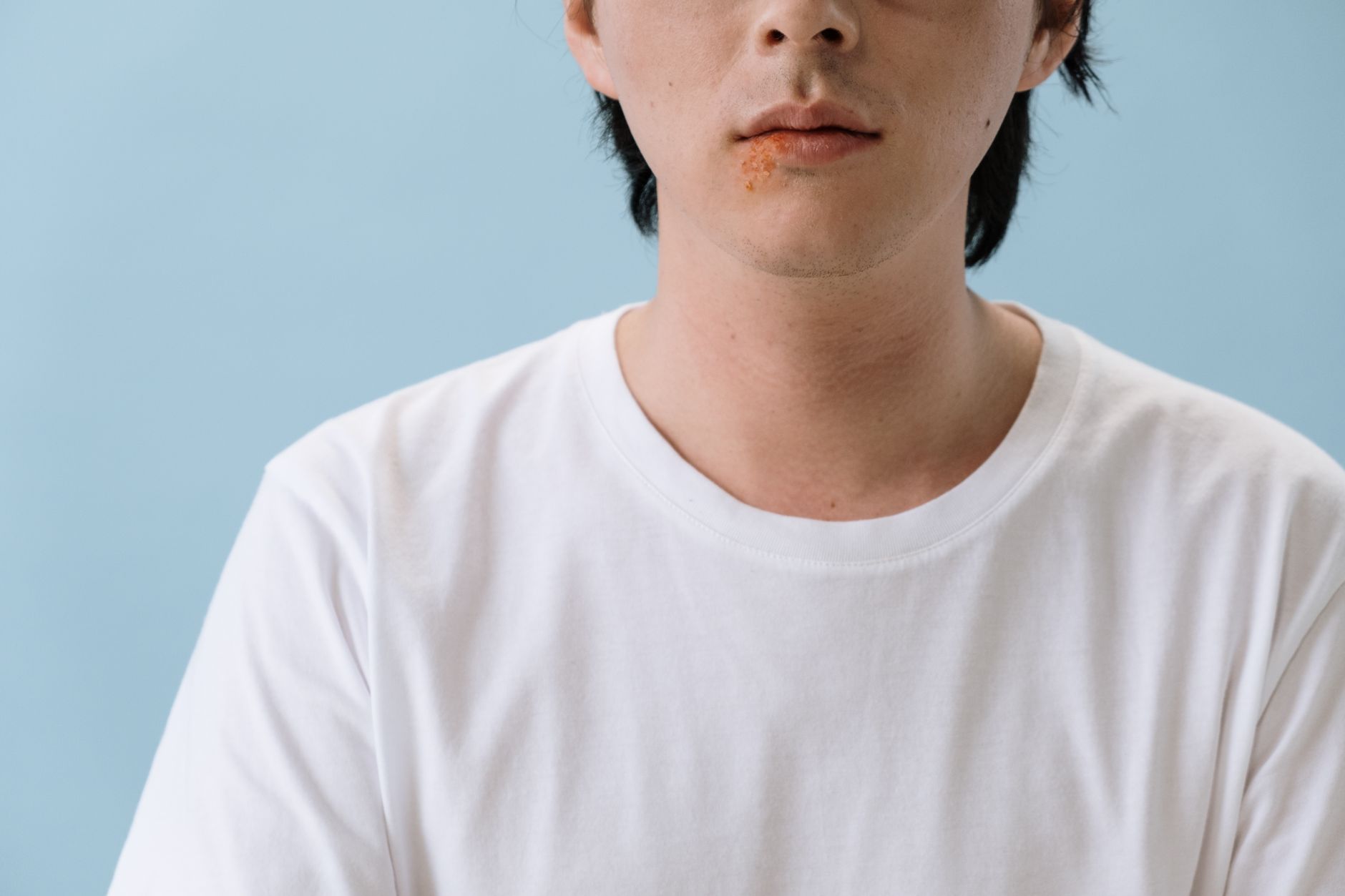 Eczema Same Places: Practical Guide - educational article image