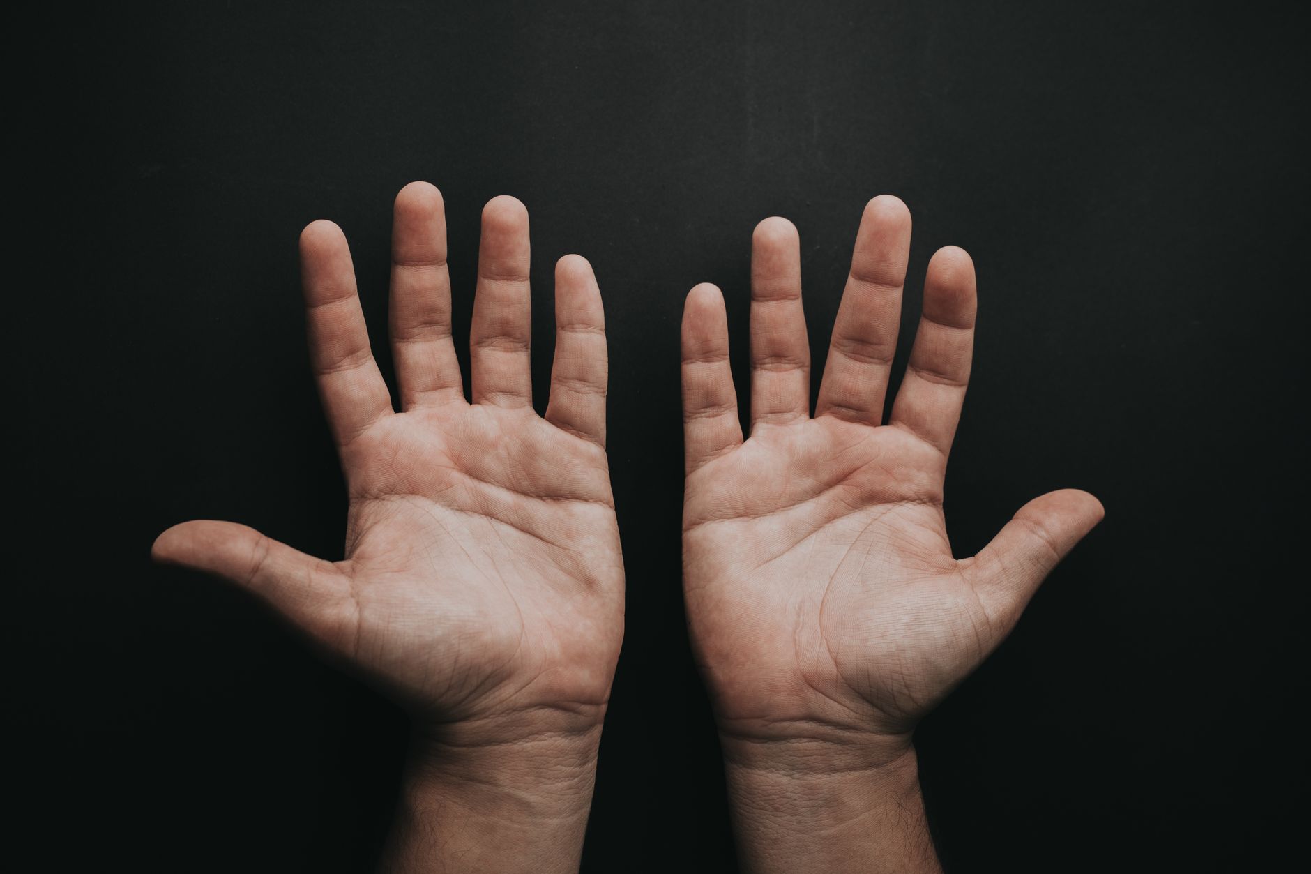 Why Does Eczema Itch So Intensely Even When Skin Looks Mild? - educational article image