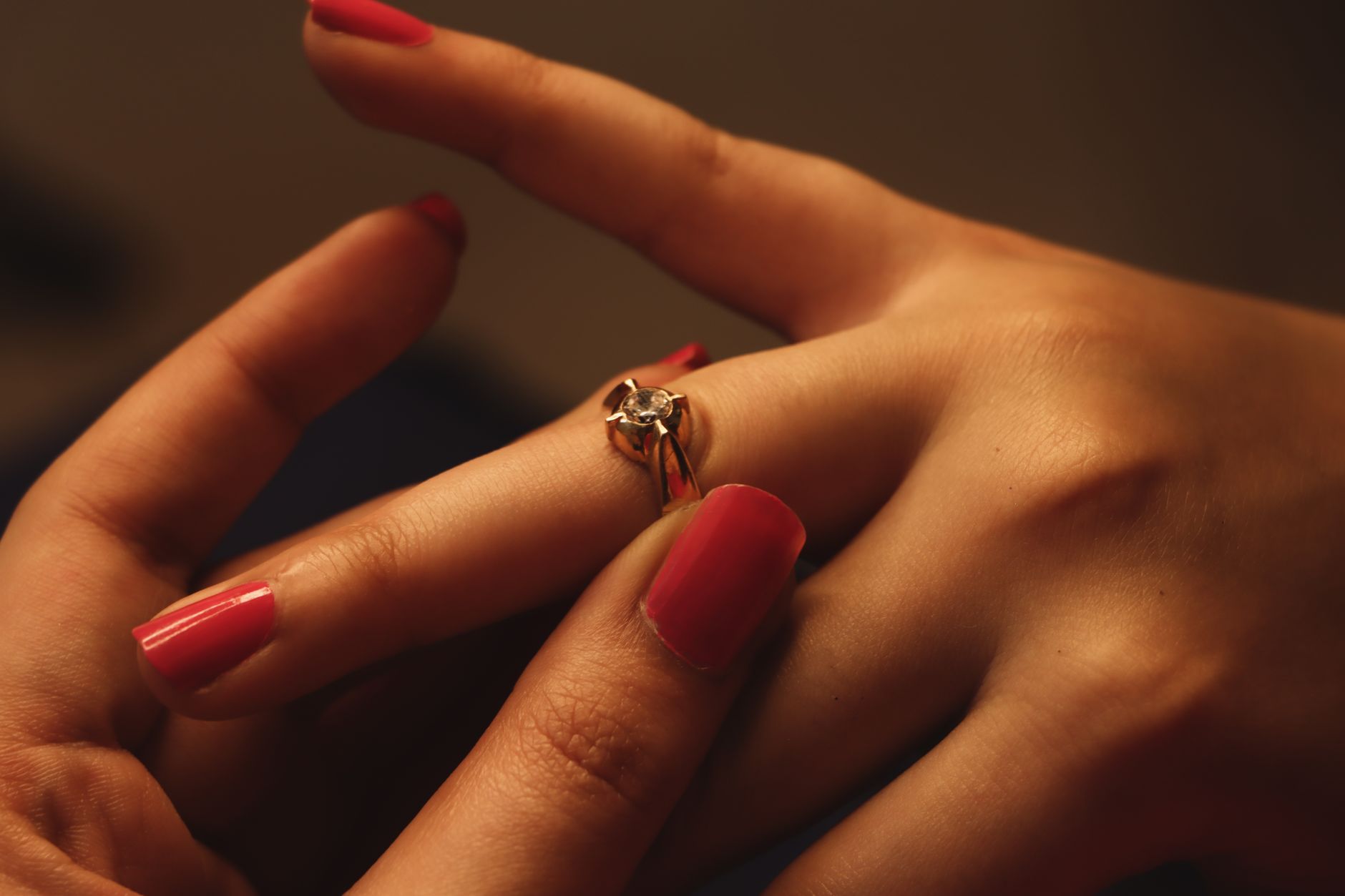 Hand Eczema Flare Under Rings Watches: Practical Guide - educational article image