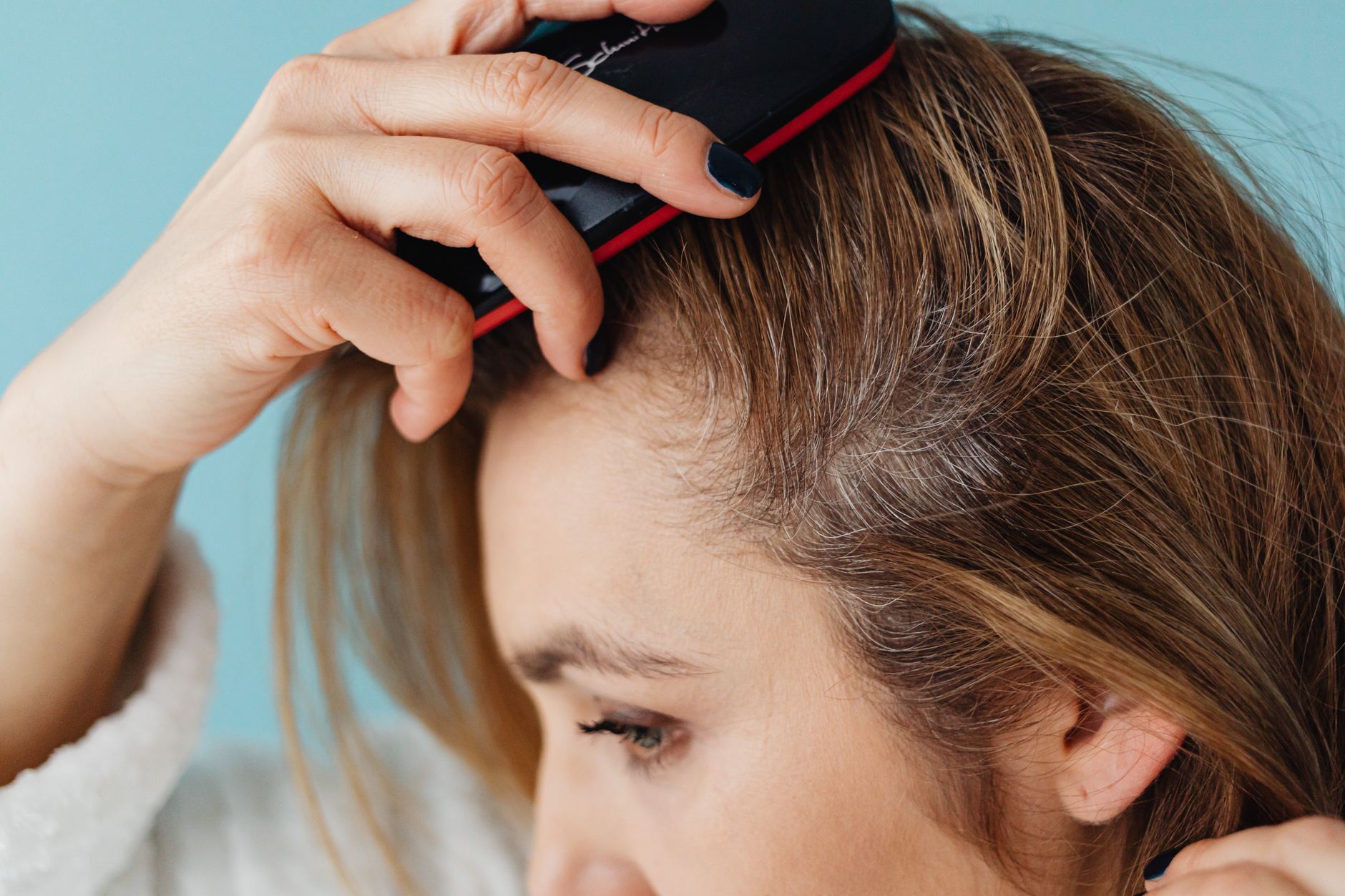 How to Manage Eczema at the Hairline: Expert Tips and Strategies - educational article image