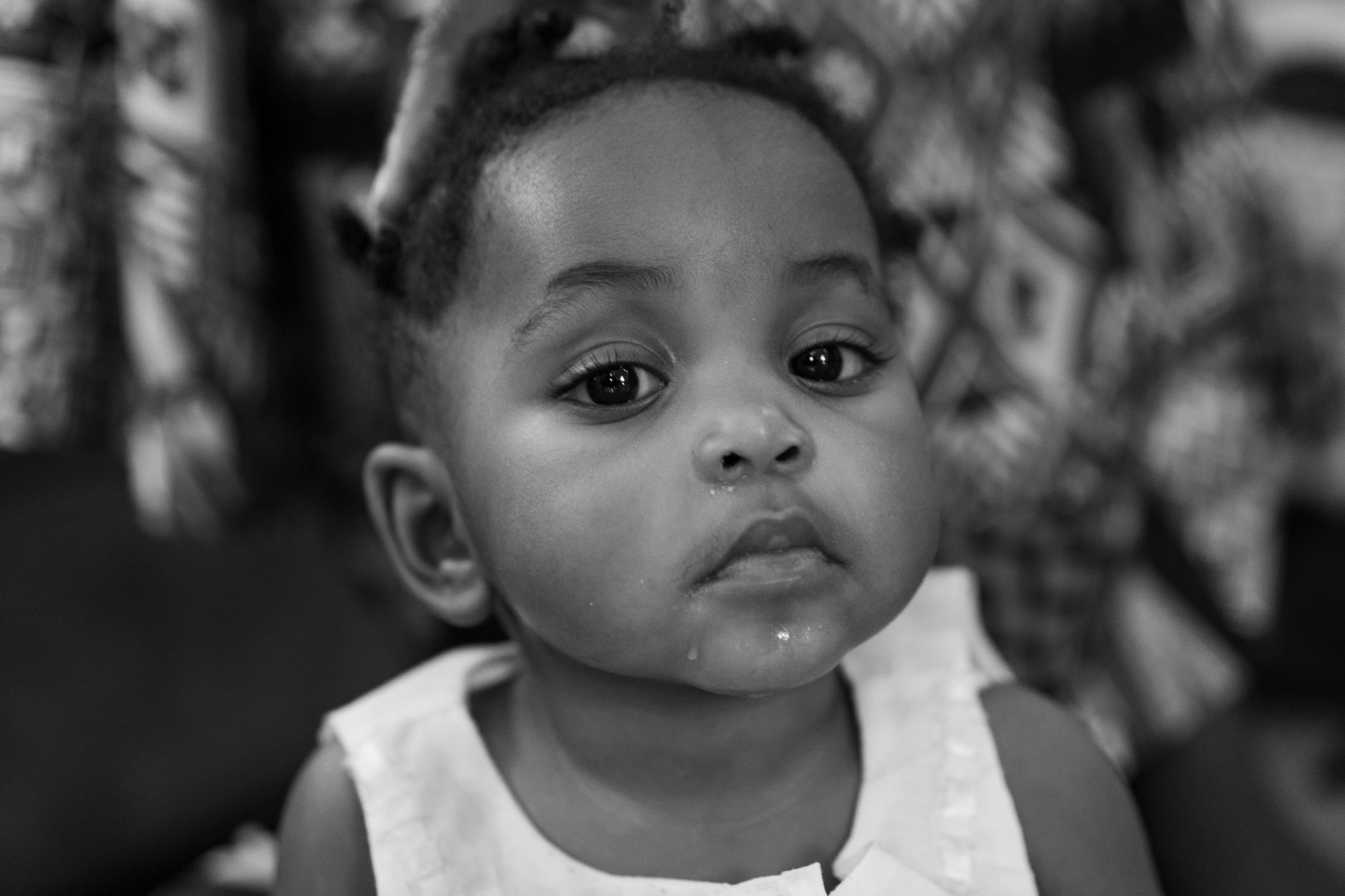 Drool Trigger Eczema Baby: Practical Guide - educational article image