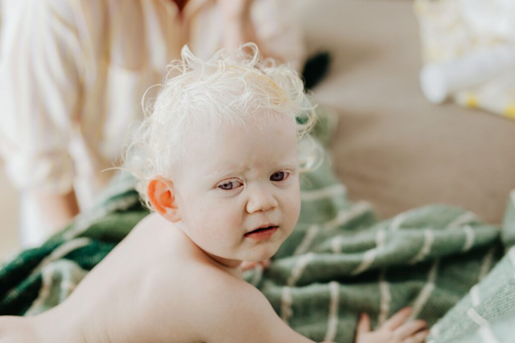 Drool Trigger Eczema Baby: Practical Guide
