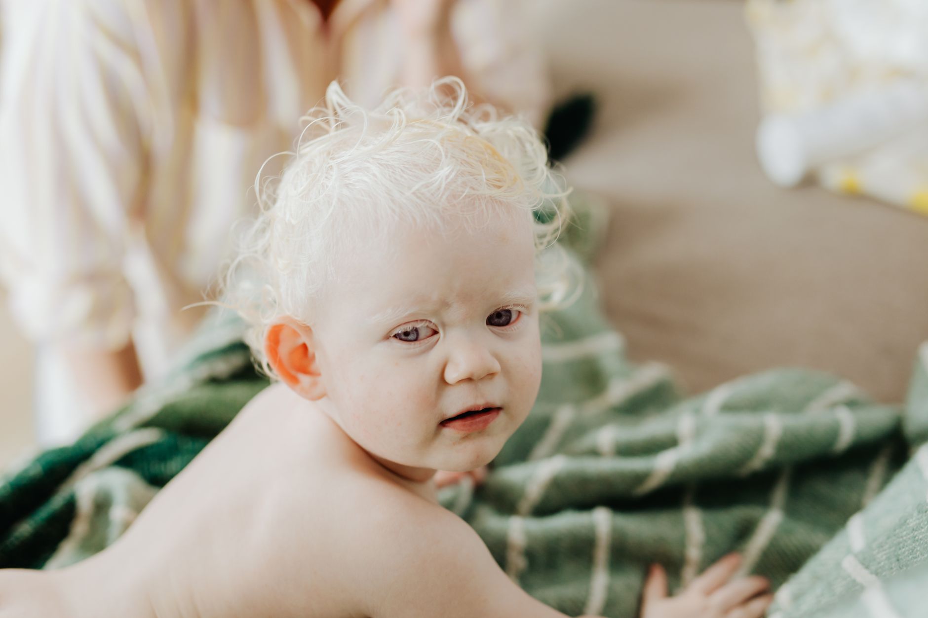 Drool Trigger Eczema Baby: Practical Guide - article image