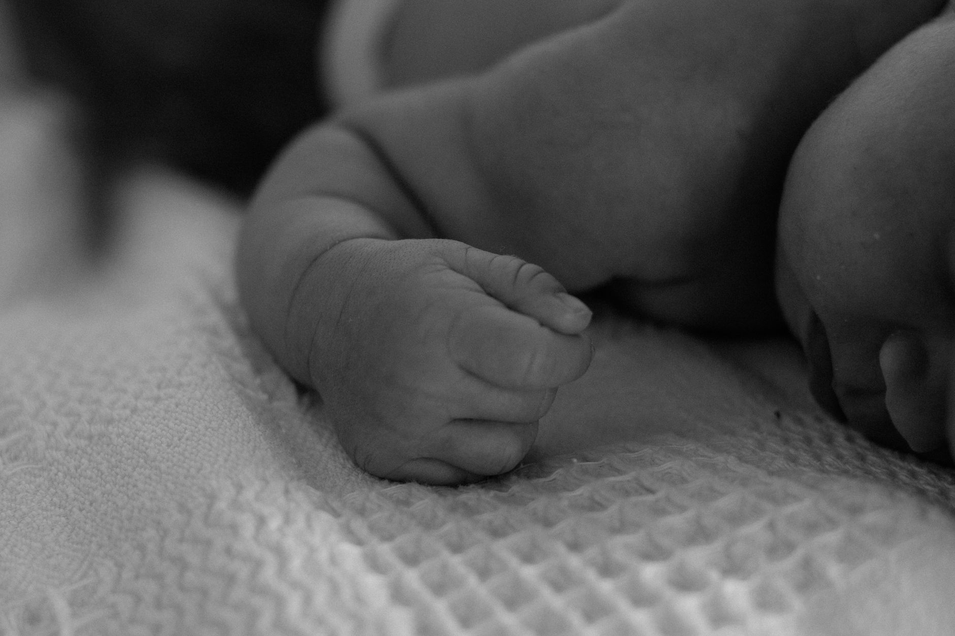 Baby Eczema Medical Attention: Practical Guide - educational article image